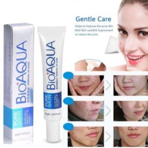 Bio Aqua Acne Cream | Skin Care Solution